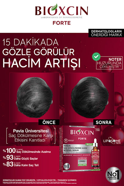 Bioxcin Forte Yoğun Saç Dökülmesine Karşı Bitkisel Serum