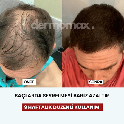 DermoMax Akıllı Tarak