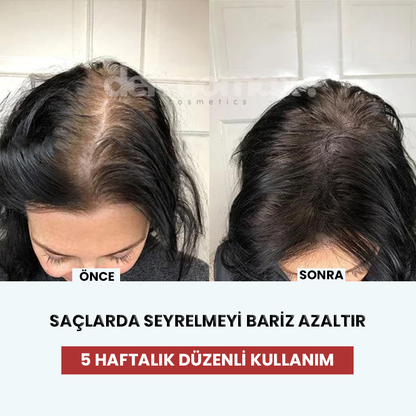 DermoMax Akıllı Tarak