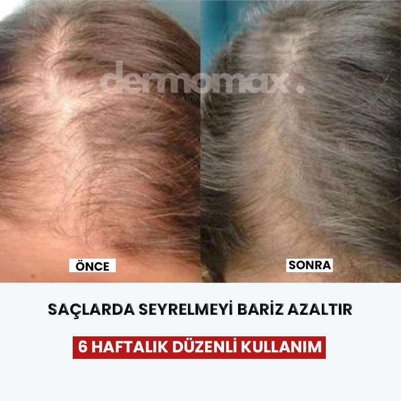 DermoMax Akıllı Tarak