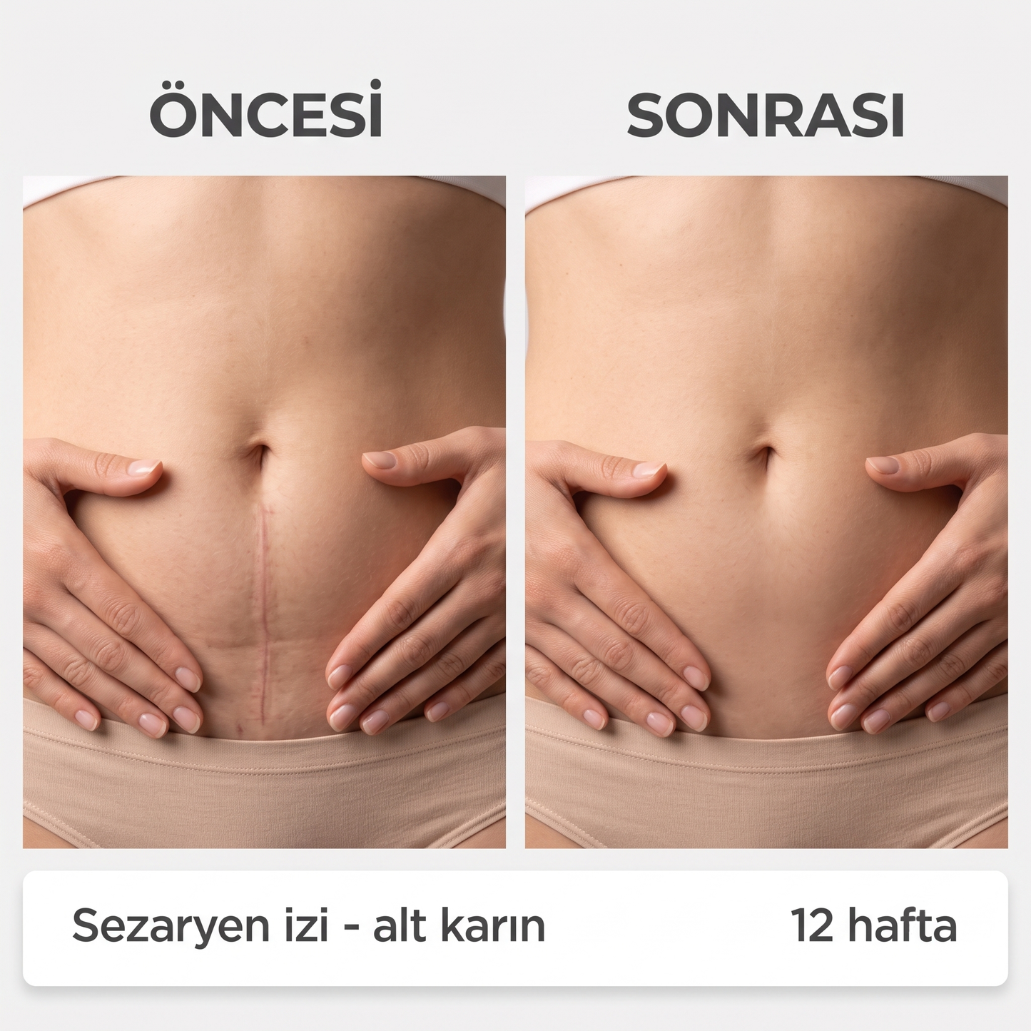 DermoMax Cilt Yenileyici Stick
